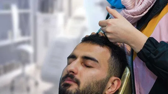 مزوتراپی مو چیست؟