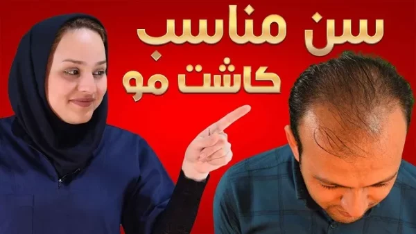 سن کاشت مو چقدر است؟ بهترین سن برای کاشت مو