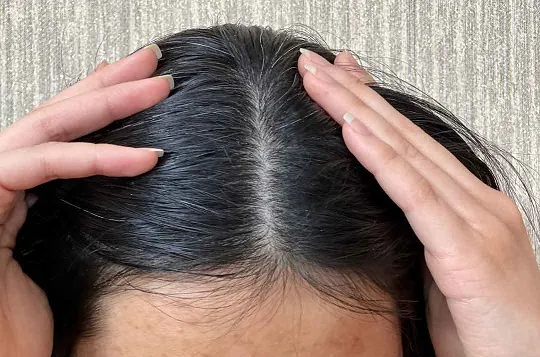 علت شوره زدن مو چیست؟ تفاوت پوسته با شوره