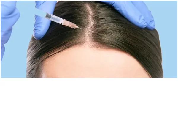 هزینه کربوکسی تراپی مو چقدر است؟ - بررسی قیمت کربوکسی تراپی مو