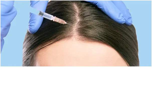 هزینه کربوکسی تراپی مو چقدر است؟ - بررسی قیمت کربوکسی تراپی مو