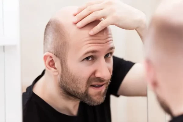 بررسی کامل عوارض قلیان - آیا کشیدن قلیان باعث ریزش مو می‌شود؟
