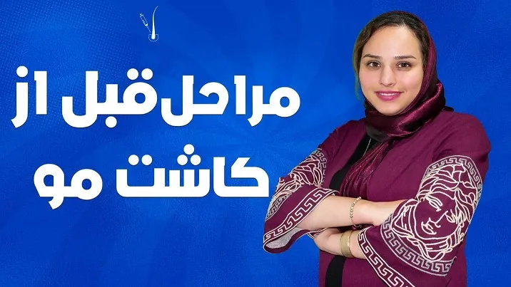 آشنایی با مهمترین مراحل کاشت مو