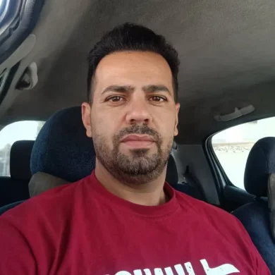 بعد از کاشت مو