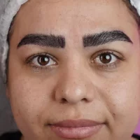 eyebrow transplant model – after 13 بعد از کاشت ابرو