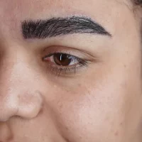 eyebrow transplant model – after 14 بعد از کاشت ابرو