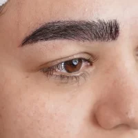 eyebrow transplant model – after 15 بعد از کاشت ابرو