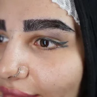 eyebrow transplant model – after 6 بعد از کاشت ابرو