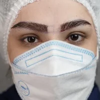 eyebrow transplant model – after 7 بعد از کاشت ابرو