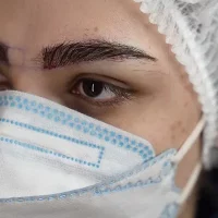 eyebrow transplant model – after 9 بعد از کاشت ابرو