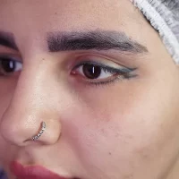 eyebrow transplant model – before 6 قبل از کاشت ابرو