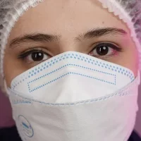 eyebrow transplant model – before 7 قبل از کاشت ابرو